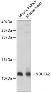 Western blot analysis of extracts of various cell lines using NDUFA2 Polyclonal Antibody at dilution of 1:1000.