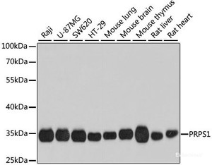 Western blot analysis of extracts of various cell lines using PRPS1 Polyclonal Antibody at dilution of 1:1000.