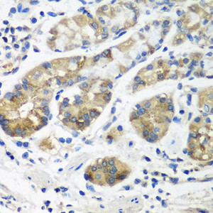 Immunohistochemistry of paraffin-embedded Human stomach using STX16 Polyclonal Antibody at dilution of 1:100 (40x lens) .