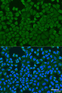 Immunofluorescence analysis of U2OS cells using IL27RA Polyclonal Antibody at dilution of 1:100. Blue: DAPI for nuclear staining.