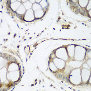 Immunohistochemistry of paraffin-embedded Human gastric using TAZ Polyclonal Antibody at dilution of 1:200 (40x lens) .