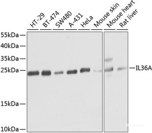 Western blot analysis of extracts of various cell lines using IL36A Polyclonal Antibody at dilution of 1:1000.