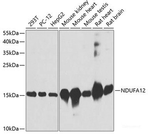 Western blot analysis of extracts of various cell lines using NDUFA12 Polyclonal Antibody at dilution of 1:3000.