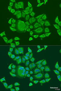 Immunofluorescence analysis of U2OS cells using DHX58 Polyclonal Antibody at dilution of 1:100. Blue: DAPI for nuclear staining.