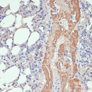 Immunohistochemistry of paraffin-embedded Rat lung using WNT5B Polyclonal Antibody at dilution of 1:100 (40x lens) .