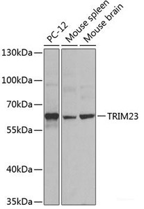 Western blot analysis of extracts of various cell lines using TRIM23 Polyclonal Antibody at dilution of 1:1000.