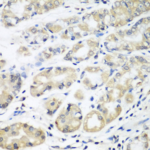 Immunohistochemistry of paraffin-embedded Human stomach using HLA-DMB Polyclonal Antibody at dilution of 1:100 (40x lens) .