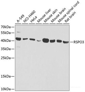 Western blot analysis of extracts of various cell lines using RSPO3 Polyclonal Antibody at dilution of 1:1000.