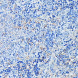 Immunohistochemistry of paraffin-embedded Rat spleen using CR2 Polyclonal Antibody at dilution of 1:100 (40x lens) .