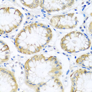 Immunohistochemistry of paraffin-embedded Human stomach using PCDHA12 Polyclonal Antibody at dilution of 1:100 (40x lens) .