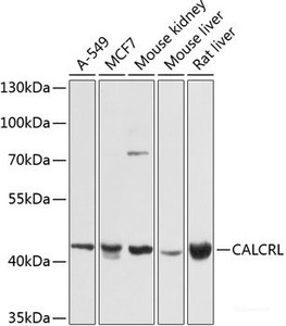 Western blot analysis of extracts of various cell lines using CALCRL Polyclonal Antibody at dilution of 1:1000.