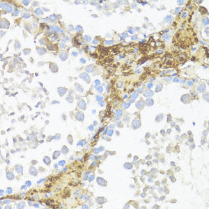 Immunohistochemistry of paraffin-embedded Mouse leydig cells using AMH Polyclonal Antibody at dilution of 1:100 (40x lens) .