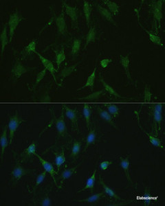 Immunofluorescence analysis of C6 cells using TRPV1 Polyclonal Antibody at dilution of 1:100. Blue: DAPI for nuclear staining.