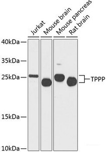 Western blot analysis of extracts of various cell lines using TPPP Polyclonal Antibody at dilution of 1:1000.