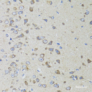 Immunohistochemistry of paraffin-embedded Rat brain using AIFM3 Polyclonal Antibody at dilution of 1:100 (40x lens) .