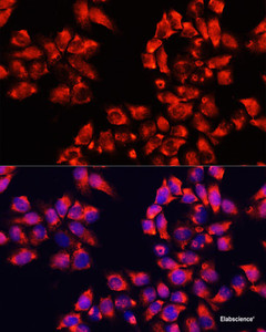 Immunofluorescence analysis of HeLa cells using ALDH7A1 Polyclonal Antibody at dilution of 1:100. Blue: DAPI for nuclear staining.