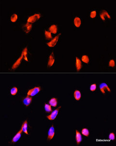 Immunofluorescence analysis of HeLa cells using ANXA3 Polyclonal Antibody at dilution of 1:100 (40x lens) . Blue: DAPI for nuclear staining.