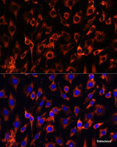 Immunofluorescence analysis of C6 cells using MCTS1 Polyclonal Antibody at dilution of 1:100 (40x lens) . Blue: DAPI for nuclear staining.