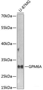 Western blot analysis of extracts of U-87MG cells using GPM6A Polyclonal Antibody at dilution of 1:1000.