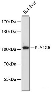 Western blot analysis of extracts of Rat liver using PLA2G6 Polyclonal Antibody at dilution of 1:1000.