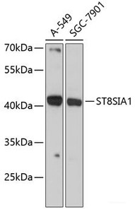 Western blot analysis of extracts of various cell lines using ST8SIA1 Polyclonal Antibody at dilution of 1:3000.