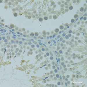 Immunohistochemistry of paraffin-embedded Rat testis using CTAG1B Polyclonal Antibody at dilution of 1:100 (40x lens) .