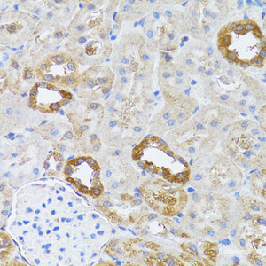 Immunohistochemistry of paraffin-embedded Rat kidney using RNASEL Polyclonal Antibody at dilution of 1:100 (40x lens) .