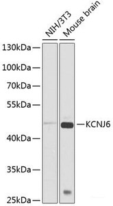 Western blot analysis of extracts of various cell lines using KCNJ6 Polyclonal Antibody at dilution of 1:1000.