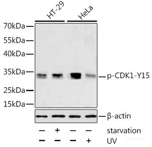 Western blot analysis of extracts of HT-29 and HeLa cells using Phospho-CDK1 (Y15) Polyclonal Antibody at dilution of 1:1000. HT-29 cells were treated by serum-starvation overnight. HeLa cells were treated by UV for 15-30 minutes.