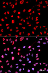 Immunofluorescence analysis of MCF-7 cells using Phospho-Dnmt1 (pS714) Polyclonal Antibody