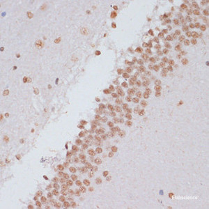 Immunohistochemistry of paraffin-embedded Rat brain using Phospho-Stat3 (Y705) Polyclonal Antibody at dilution of 1:100 (40x lens) .