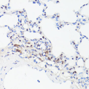 Immunohistochemistry of paraffin-embedded Rat lung using Phospho-MYC (S62) Polyclonal Antibody at dilution of 1:100 (40x lens) .