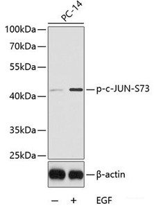 Western blot analysis of extracts from PC14 cells using Phospho-c-JUN (S73) Polyclonal Antibody.