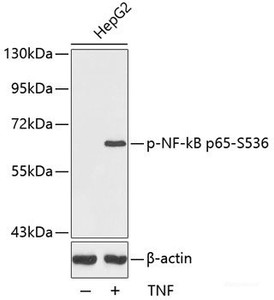 Western blot analysis of extracts from HepG2 cells using Phospho-NF-kB p65 (S536) Polyclonal Antibody.