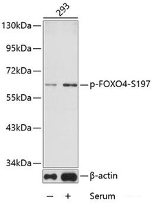 Western blot analysis of extracts from 293 cells using Phospho-FOXO4 (S197) Polyclonal Antibody.