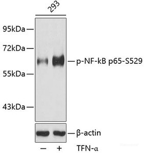 Western blot analysis of extracts from 293 cells using Phospho-NF-kB p65 (S529) Polyclonal Antibody.