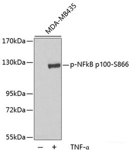 Western blot analysis of extracts of MDA-MB435 cells using Phospho-NFkB p100 (S866) Polyclonal Antibody.