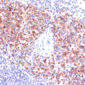 Immunohistochemistry of paraffin-embedded Mouse spleen using Phospho-NF-kB p65 (S311) Polyclonal Antibody at dilution of 1:100 (40x lens) .