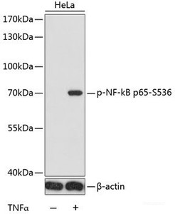 Western blot analysis of extracts of HeLa cells using Phospho-NF-kB p65 (S536) Polyclonal Antibody at dilution of 1:1000. HeLa cells were treated by TNF-α (20ng/ml) for 30 minutes.