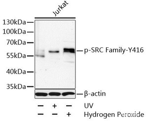 Western blot analysis of extracts of Jurkat cells using Phospho-SRC Family（Y416） Polyclonal Antibody at dilution of 1:1000.