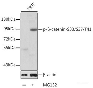 Western blot analysis of extracts of 293T cells using Phospho-β-catenin (S33/S37/T41) Polyclonal Antibody.