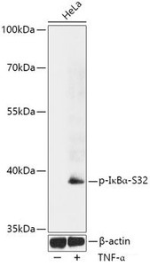 Western blot analysis of extracts of HeLa cells using Phospho-NFKBIA (S32) Polyclonal Antibody at dilution of 1:1000. HeLa cells were treated by TNF-α (20 ng/ml) at 37°C for 30 minutes.