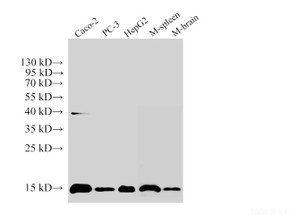 Western Blot analysis of 1) Caco-2, 2) PC-3, 3) HepG2, 4) Mouse Spleen, 5) Mouse brain using Histone H3 Polyclonal Antibody at dilution of 1:250000