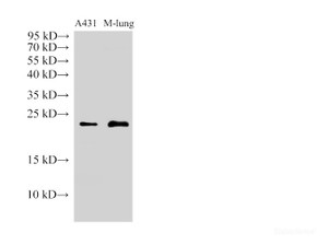 Western Blot analysis of A431 and Mouse lung using CAV1 Polyclonal Antibody at dilution of 1:1000.