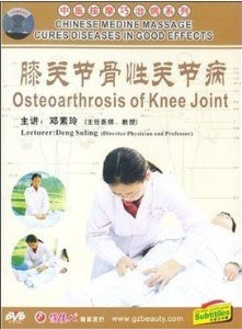 Osteoarthrosis of Knee Joint - (WK2W)