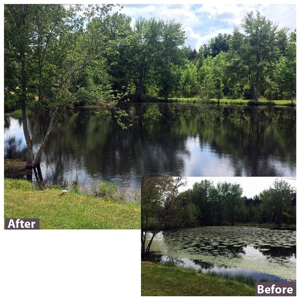 Before and After Sonar Q Treatment