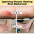 Manuka Honey for Wounds, Speed up Healing for Cuts, Surgical Wounds, Scars, Foot Ulcers, Infection, Burns, Non-Sticky, Easy to Apply, 40g