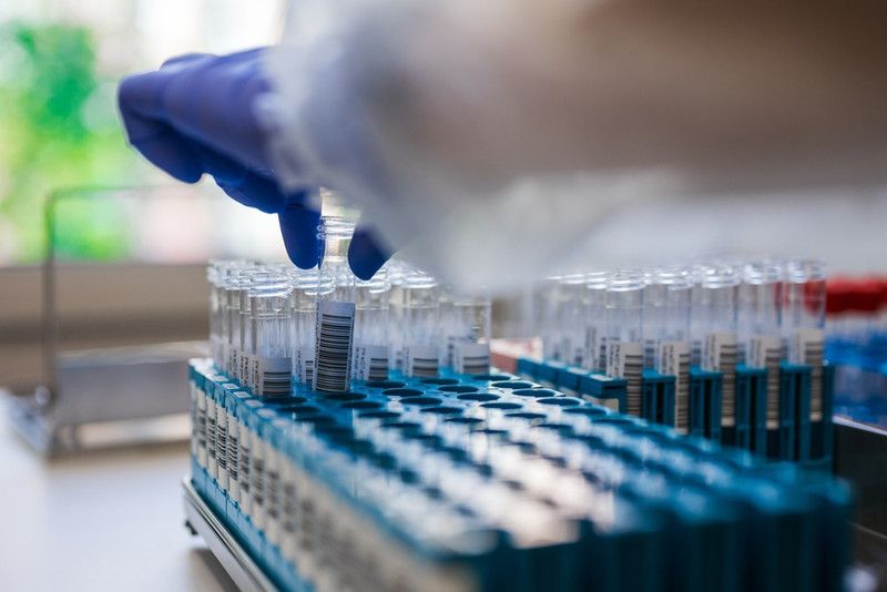 Vial Labeling Guide: How to Properly Apply Labels to Frozen Vials