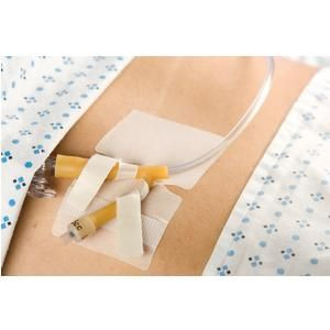 Cath-Secure Dual Tab