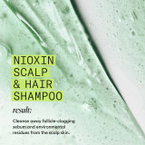Nioxin SCALP + HAIR THICKENING SYSTEM 2 SHAMPOO 300ML Nioxin SCALP + HAIR THICKENING SYSTEM 2 SHAMPOO 300ML